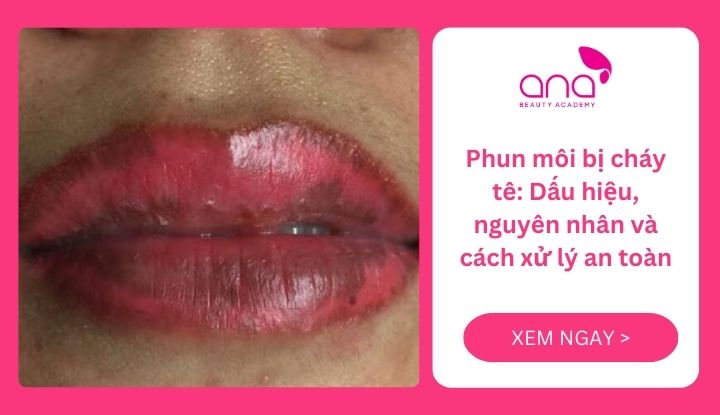 phun môi bị cháy tê