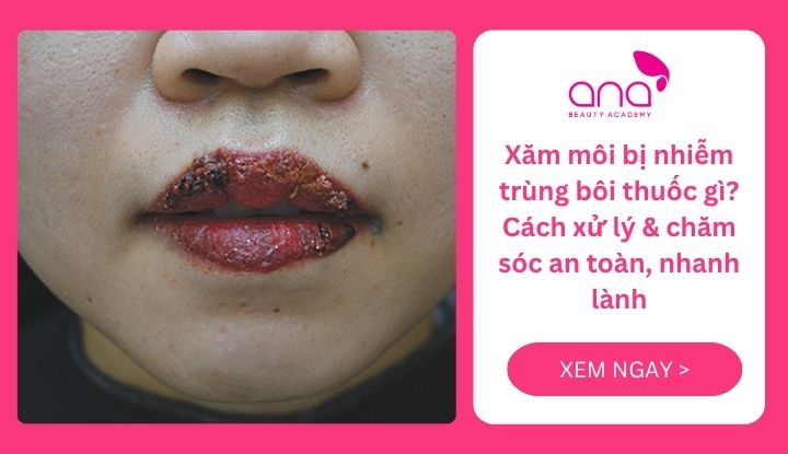 xăm môi bị nhiễm trùng bôi thuốc gì