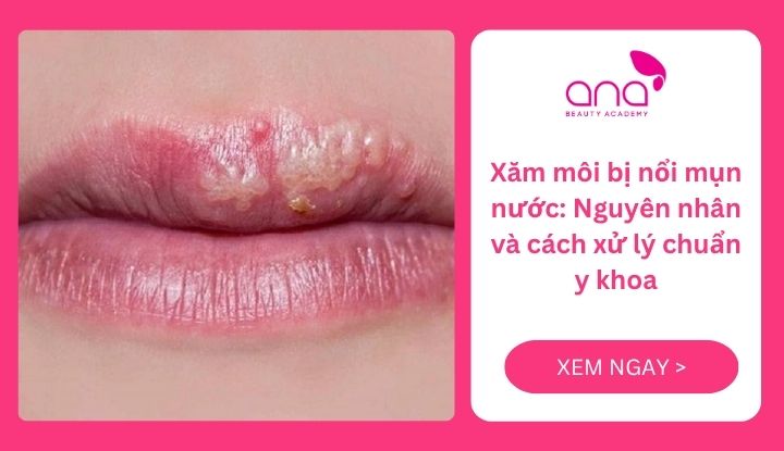 xăm môi bị nổi mụn nước